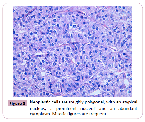 clinical-and-molecular-endocrinology-neoplastic-cells