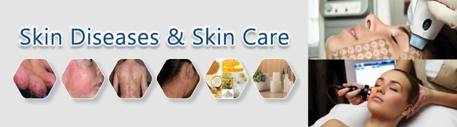 Skin Diseases & Skin Care