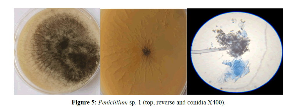 asian-plant-human-reverse-conidia