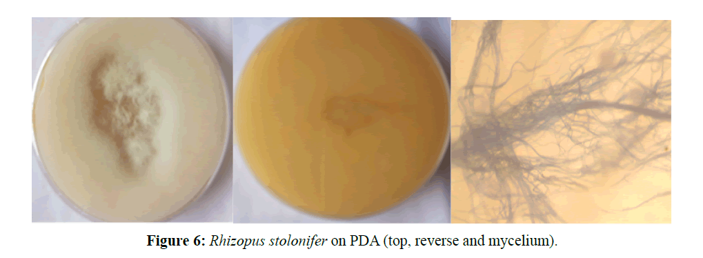 asian-plant-human-reverse-mycelium