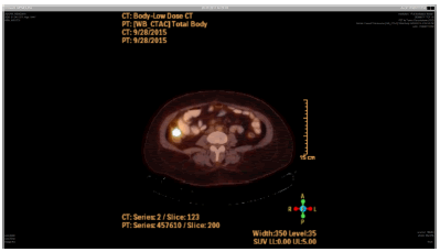 general-surgery-focal