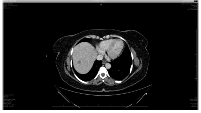 general-surgery-lesion