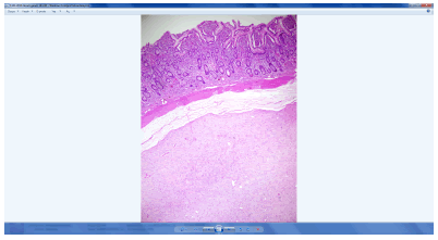 general-surgery-lesion