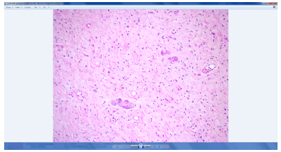 general-surgery-lesion