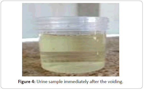 Urine