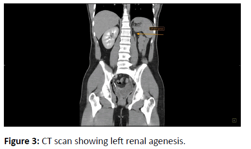 nephrology-urology-renal