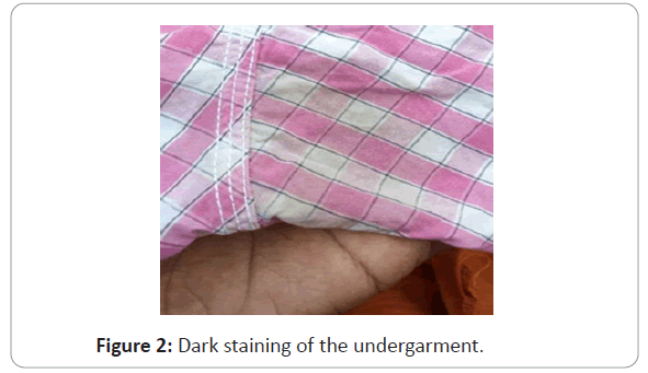 undergarment