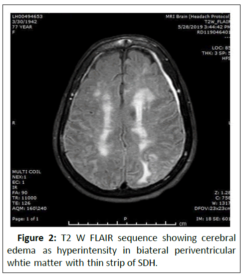 Clinical-cerebral