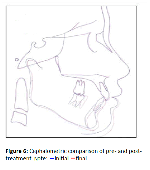 Orthodontics-Cephalometric