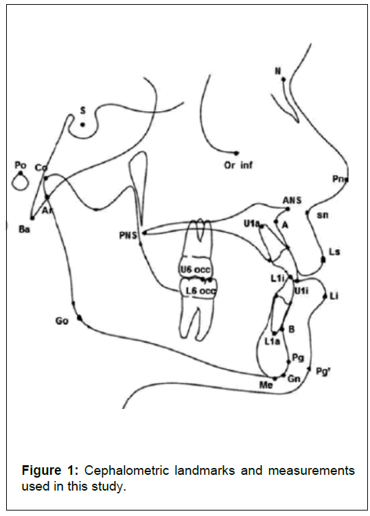 Orthodontics-Cephalometric