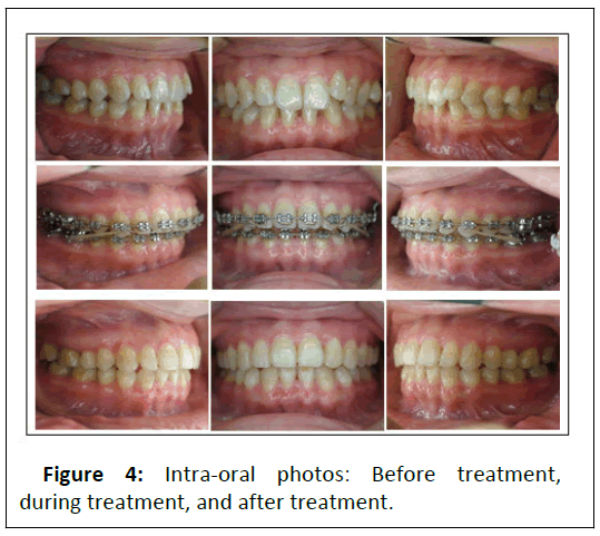 Orthodontics-Intra