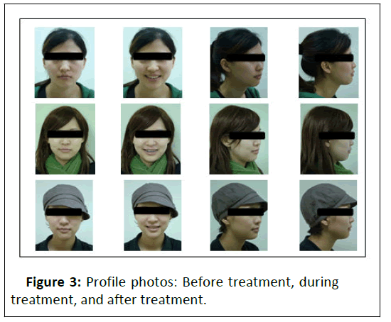 Orthodontics-Profile