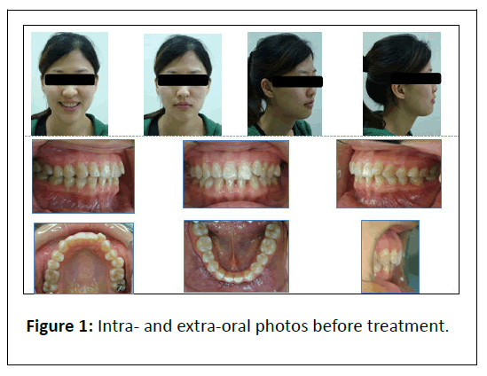 Orthodontics-oral