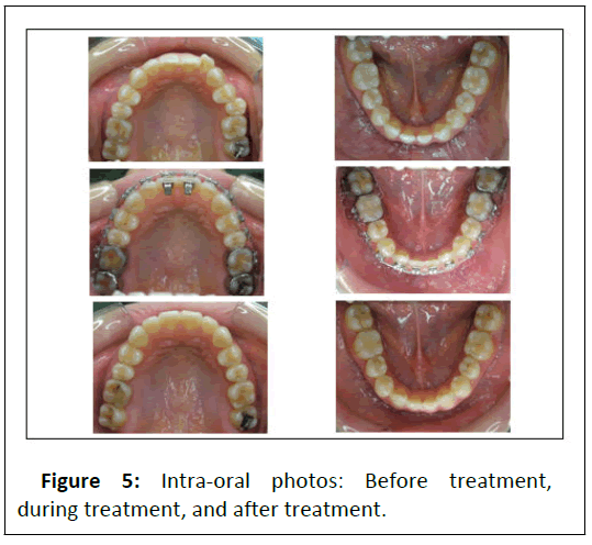 Orthodontics-oral