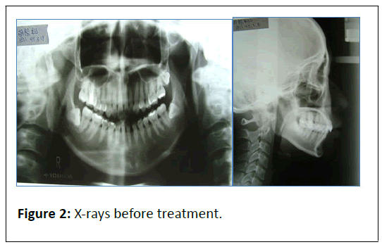 Orthodontics-treatment