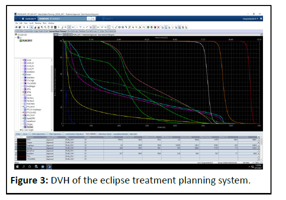 american-Journal-eclipse