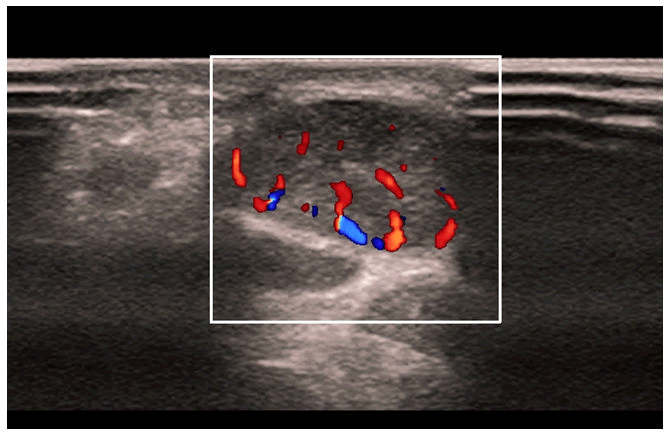 clinical-radiology-ultrasonography