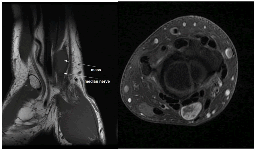 clinical-radiology-wrist