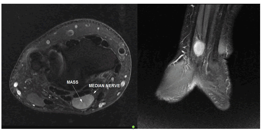 clinical-radiology-wrist