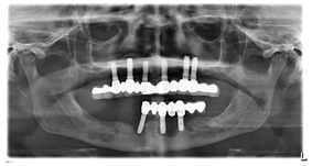 dentistry-craniofacial-bone