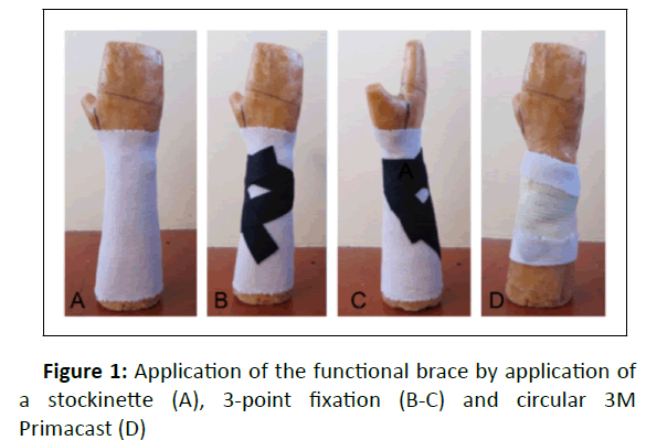 experimental-functional