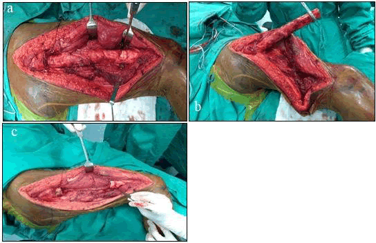 journal-clinical-bone