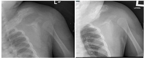 journal-clinical-left