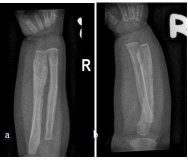 journal-clinical-radius