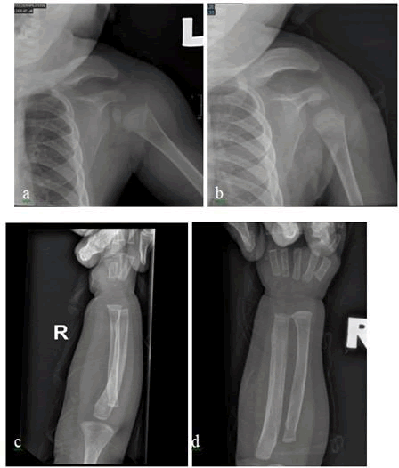 journal-clinical-shoulder