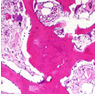 journal-neoplasm-bone