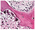 journal-neoplasm-bone