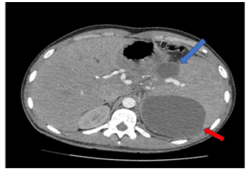 journal-rare-preoperative