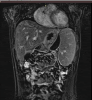 journal-rare-preoperativeT1