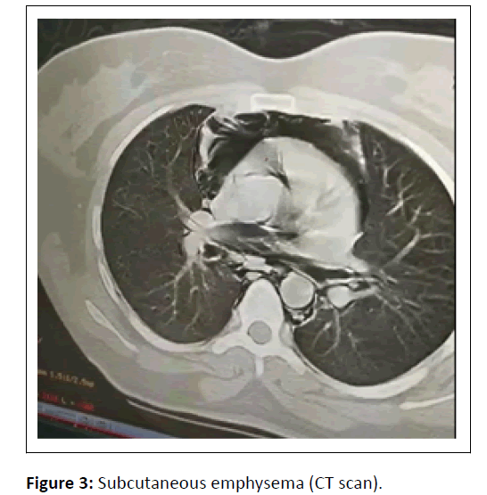 medical-case-Subcutaneous