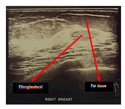 medical-case-breast