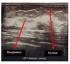 medical-case-breast