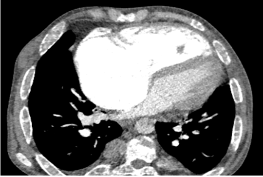 medical-case-cardiac