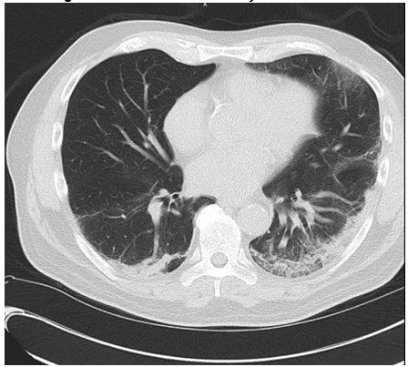 medical-case-chest