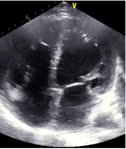 medical-case-echocardiology