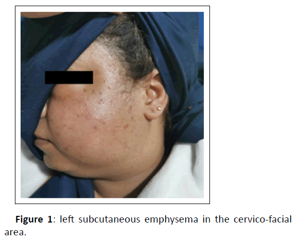 medical-case-emphysema