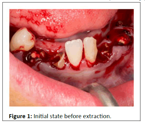 medical-case-extraction