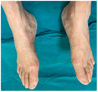 medical-case-feet