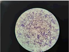 medical-case-granulopoiesis