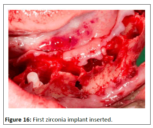 medical-case-inserted