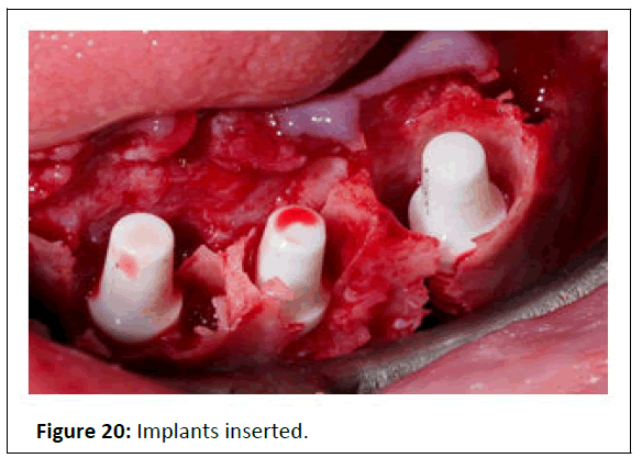 medical-case-inserted