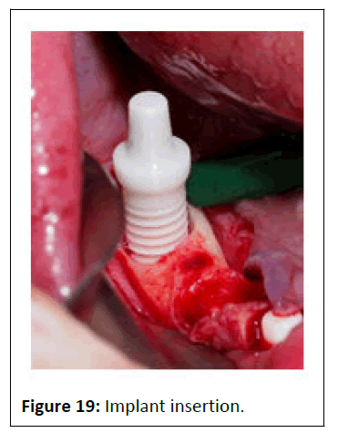 medical-case-insertion