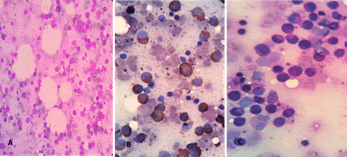 medical-case-marrow