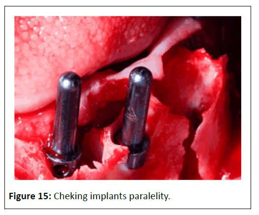 medical-case-paralelity