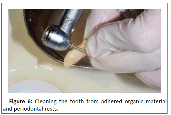 medical-case-periodontal