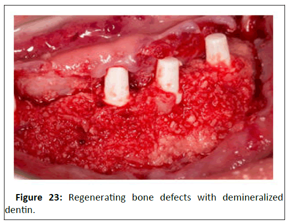 medical-case-regenerating